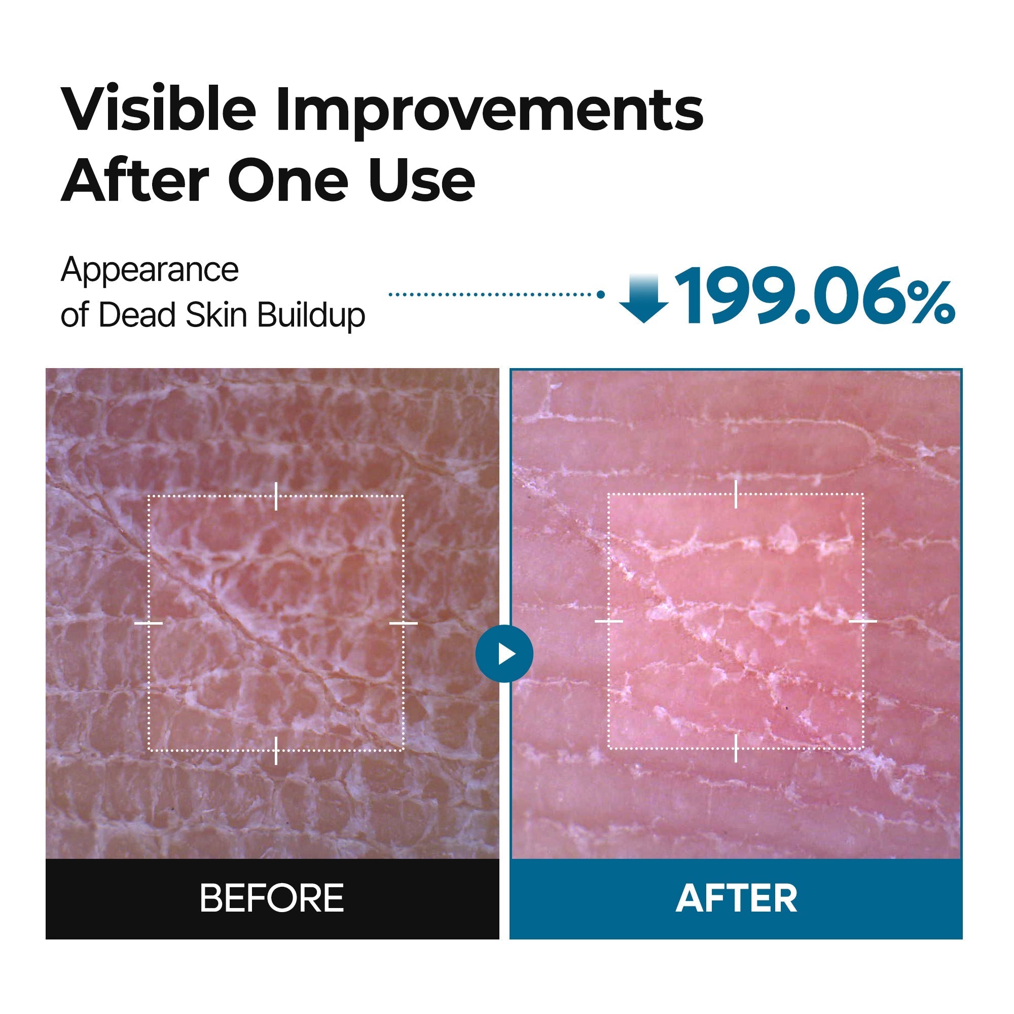 Peel Shot Exfoliating TX Spray - image 3